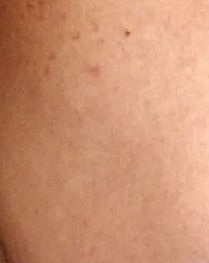 Nachher